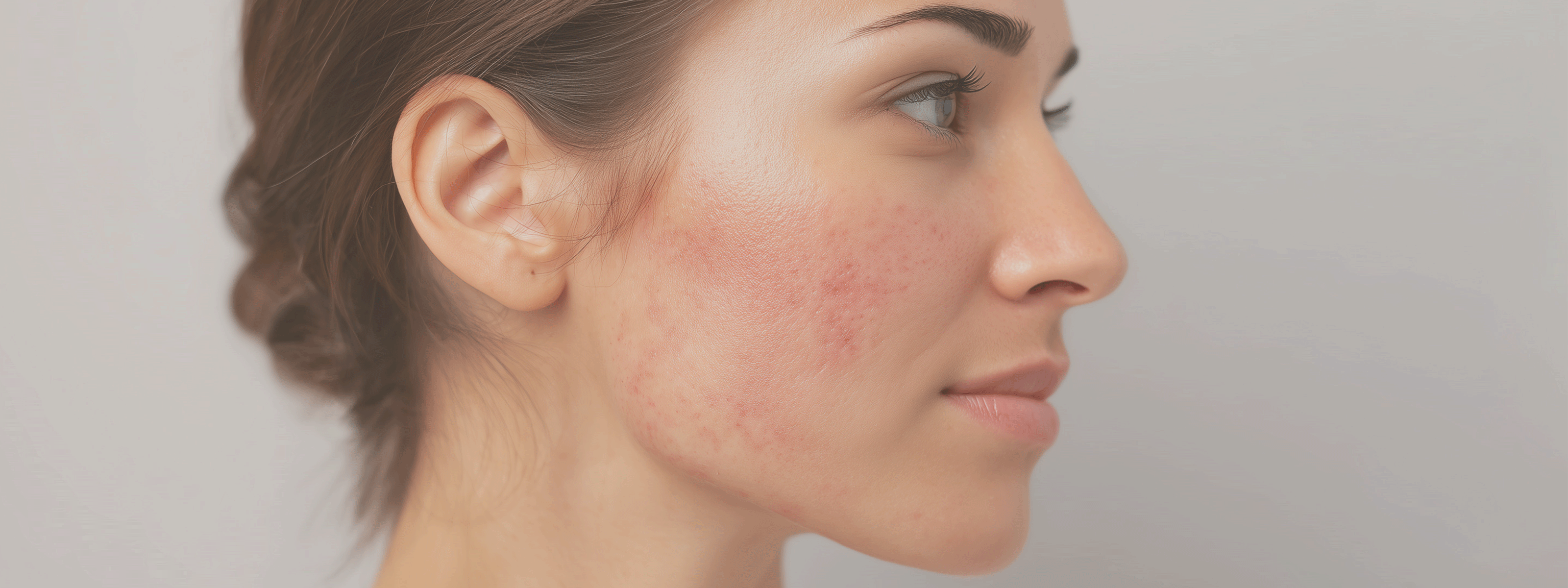 I SINTOMI DELLA DERMATITE: COME SI MANIFESTA?