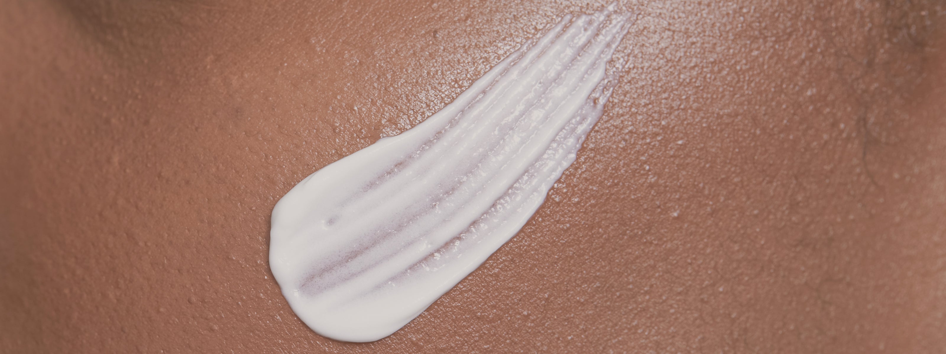 LA DERMATITE E I SUOI RIMEDI NATURALI