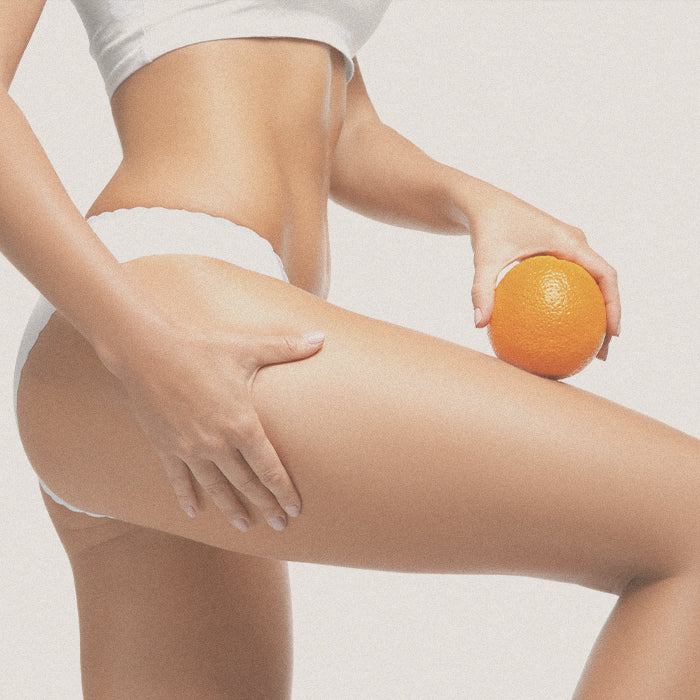 Cellulite