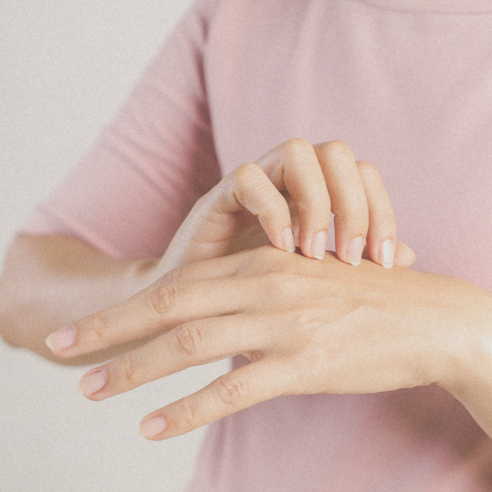 Psoriasi