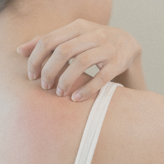 Irritazioni della pelle
